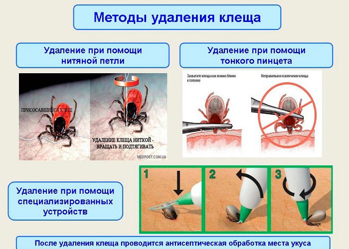 Присасывание клеща карта вызова